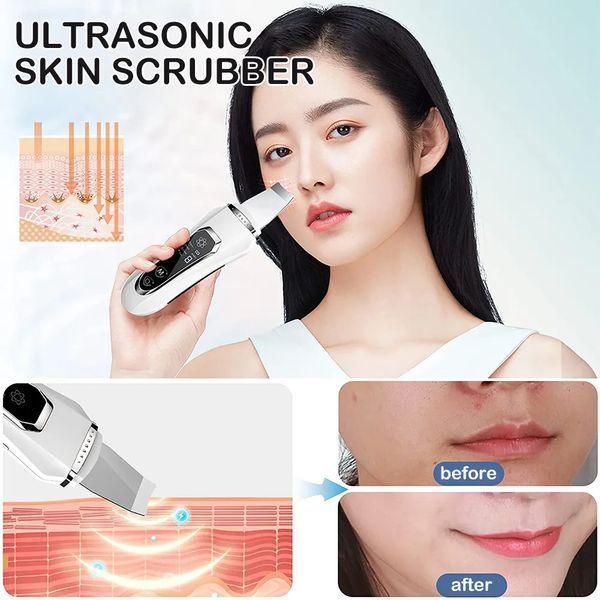 Ультразвуковий скрабер для обличчя Ultrasonic Facial Beauty Device 1964466900 фото
