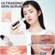 Ультразвуковий скрабер для обличчя Ultrasonic Facial Beauty Device 1964466900 фото 5